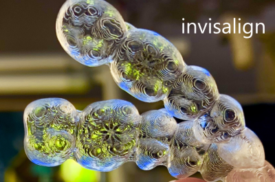 A Guide to Invisalign® (aka Clear Aligners) – Hulse Dental